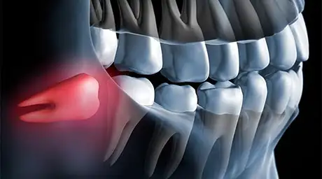 д-р-маруф-орална-хирурги